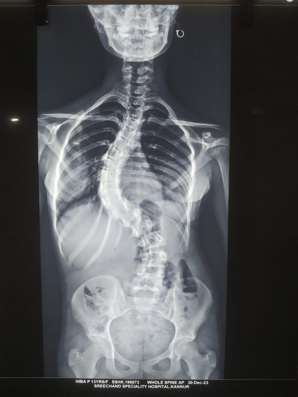 Pre-operation image 1