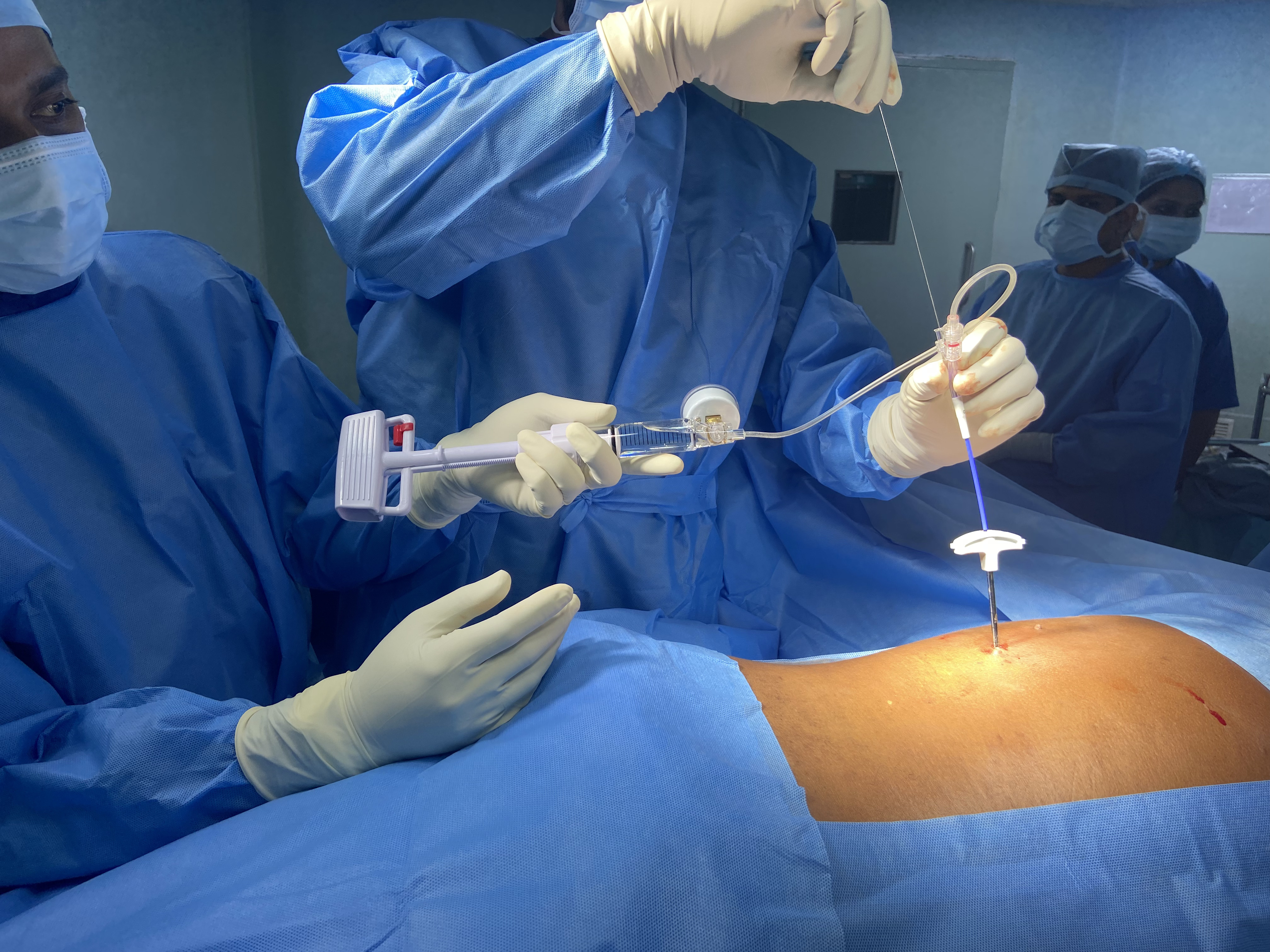 Sciatica – Causes, Symptoms, and Treatments in Kozhikode