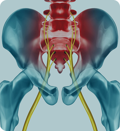 Sciatica & Nerve Compression