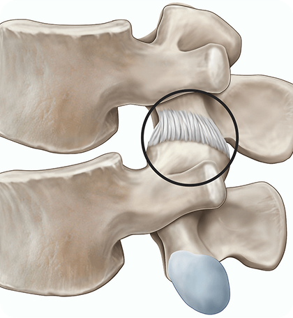 Nerve Root Blocks